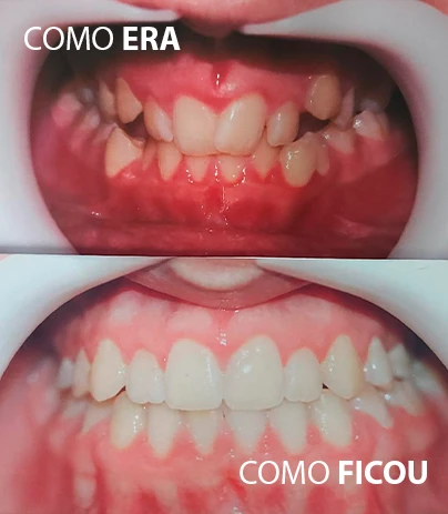 RES06